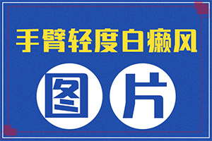 舌头白斑图片初期症状图片(常见诊断方式)-皮肤上有白块