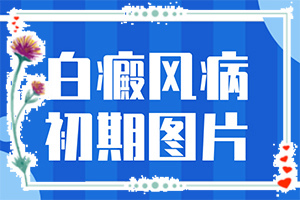 「2022皮肤科」卤米松乳膏治疗白斑好以后还继续用多久「具体分析」肛门瘙痒长白斑是怎么回事用什么药有效