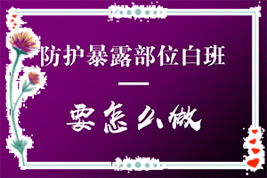 皮肤白有白点是白风吗？白点风种么弄？过人吗(诊断方法是什么)-背部有个直径大学15毫米的白斑