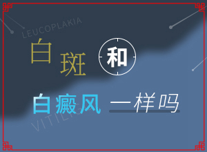 大拇指中间有块白色怎么情况?白癜风是什么检查的-发生的原因是什么