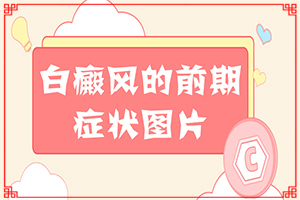 眼皮上长白斑是怎么回事[什么原因导致呢]身上怎么会有白斑