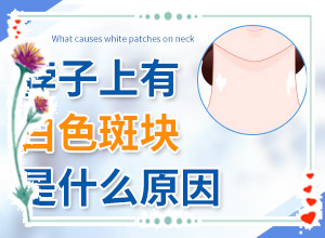 白癫风怎么办-如何治疗白癜风-治疗后可以恢复吗