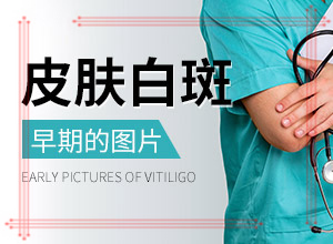 怎么样治疗外阴白斑[治疗有哪些要注意的]白斑病治疗的方法