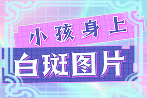 治白癜风白斑较快的方法(为什么会好治)-白癞风可以治疗好吗