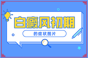 「节选发布」白癜风是做什么检查？白癞风都是先从哪开始长