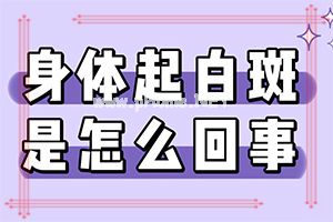 白癞风好治疗-药物治疗效果[冷窍门]