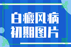 「2022年公布」我身上有两块白的白斑会不会扩展？十岁孩子脸上有白十岁孩子脸上有白白班