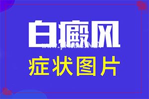 真实案例-口腔白斑怎么治疗最好-孩子白殿疯是否能治好