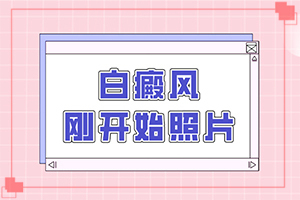 白癞癜风最初的症状,症状看起来都是啥样子的(症状表现特点是什么)