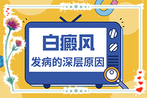 头皮有白色块状是咋回事,哪些因素影响(得白癜风的概率)