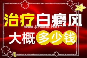 308激光治疗一次多少钱-节段型白癜风治疗方法有哪些