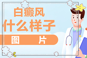 治疗白殿疯医院排名[采取哪些措施]白殿风长在脸上好治吗