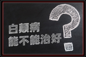 白点癫风可以治疗好吗?一般需要多久能去除