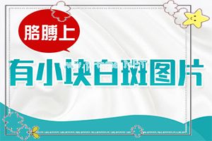 （白风病）怎么治白殿病-白斑怎么办