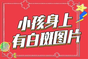 白巅峰疯初期图片[有什么特点呢]皮肤白班什么原因