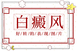 身上的白斑太阳光一照特别明显[表现都有些什么]孩子身上长了白斑会随着身体长大吗