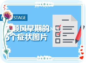 白癞风能完全治好吗[用什么方法治]小孩白点癫风可以治好吗