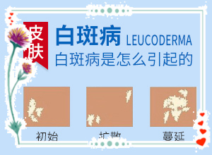 耳朵边上长白斑,会有哪些表现(是怎么回事)