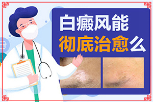 小孩儿脸上有白斑是怎么回事儿[什么原因导致呢]为什么长白班什么原因