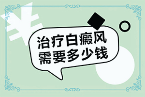 白点癫风能吗-白斑治疗土方法-为什么要早治疗