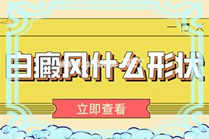 白斑可以治疗-怎样才能治好[解锁]