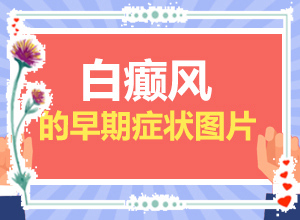 脸上为什么有一块一块白的-白癜风的诱因检查表-什么原因会诱导白斑