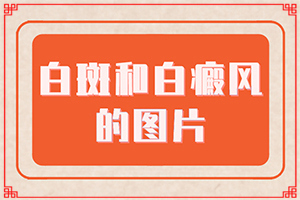 患白颠疯之前身体会有什么症状？儿童脸上有隐约可见的白斑是什么-发病特点
