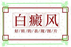 「说话」男童脸上有白斑是缺乏什么微量元素「排名公开」怎么检查白癜风诱发病因