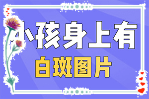 白斑在胳膊上的图片-紫光灯检查白癜风-得了会有什么特征