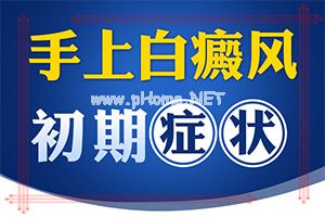 (白风癫)白殿斑早期治疗-有什么方法能改善