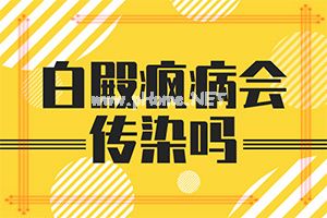 (白癞病)白癞癜风会不会遗传-不如试试这种方法