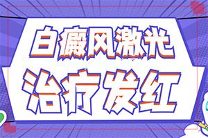 (白癞癜风)白斑能治疗好不-怎样才能治好