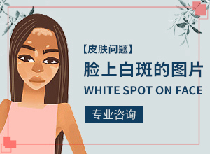 白颠疯是怎么造成的,什么因素能导致(导致的因素有哪些)