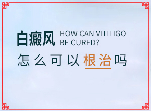 小孩脸有白斑是怎么引起的,病情加重是因为什么(分析什么原因导致)