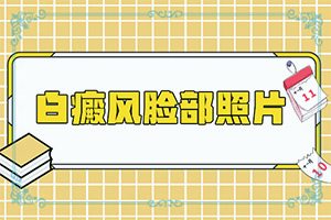 「专业看诊」白癫风发现有一年了，能治疗好吗？白斑妈妈生的宝宝胳膊上有一点白斑怎么办