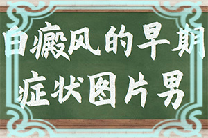 4个宝宝身上有白斑是怎么回事,这些原因是啥呢(哪些诱因引起)