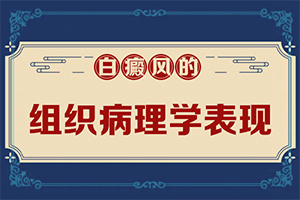 白癜风为什么易诊断-白斑图片初期-又有哪些症状表现呢