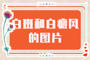 「价格公正」为什么皮肤会出现白斑?皮肤上有白斑是怎么回事
