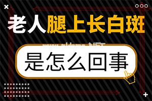 自癜风多久扩散一次-简单便民的好方法[冷窍门]