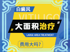 白癜风有什么症状？都有哪些表现