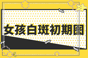 小孩手上有白斑是什么原因-色素减退白斑-有什么因素呢