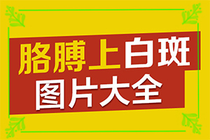 「脖子有白斑怎么办」治疗正确做法是什么?治疗正确做法是什么